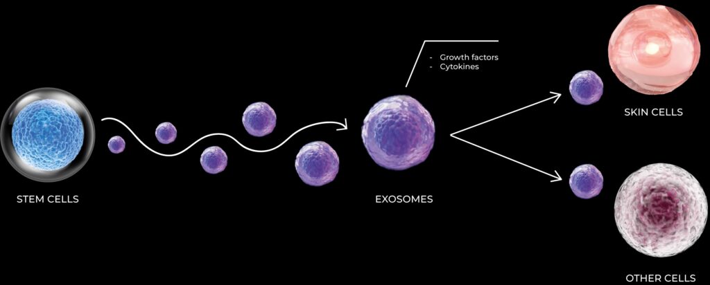 ¿SON LOS EXOSOMAS EL FUTURO DE LA MEDICINA ESTÉTICA? ¿SON LOS EXOSOMAS EL FUTURO DE LA MEDICINA ESTÉTICA?