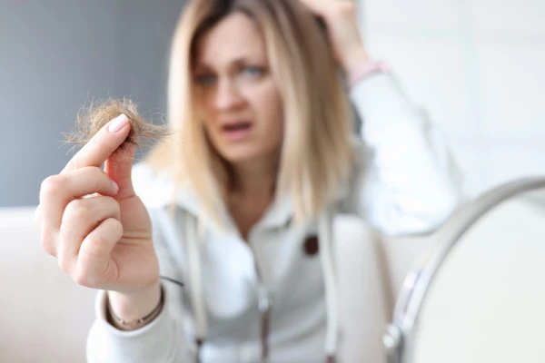 Caída del cabello en mujeres: causas y cuando preocuparse 4 Caída del cabello en las mujeres.