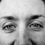Mirada cansada: causas, tratamientos y soluciones