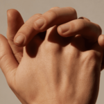 Peeling de la piel de las manos: causas, tratamiento y prevención.