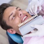 ¿Qué tipo de caras dentales son las menos invasivas?