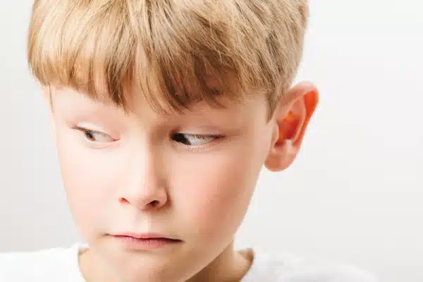 Oídos prominentes en niños Hijos prominentes de los oídos