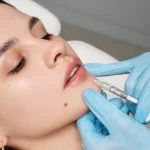Retire los labios permanentes