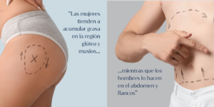 La importancia de la personalización en la cirugía estética 4 hombres lipo