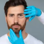 Blefaroplastia masculina | Clínica facial España