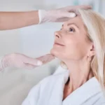 Lifting facial mal hecho: consecuencias y cómo corregirlo Lifting facial mal hecho: consecuencias y cómo corregirlo
