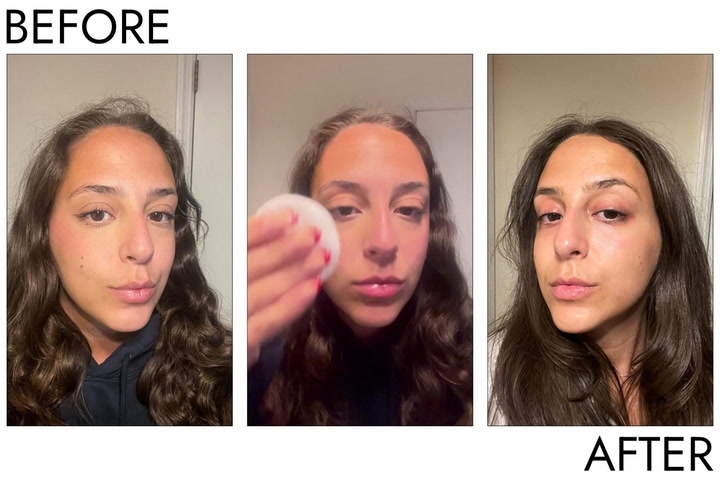 Site Loop: Person’s eye before and after using Garnier SkinActive Micellar Cleansing Water All-in-1 Makeup Remover & Cleanser