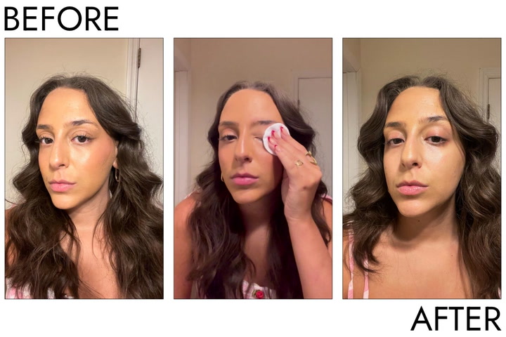 Site Loop: Person’s eye before and after using Drunk Elephant E-rase Milki Micellar Water