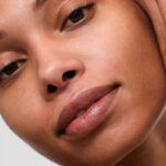 Diez tratamientos para la hiperplasia sebácea, según Derms